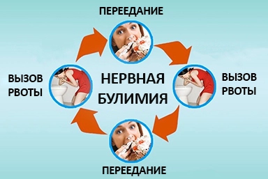 Лечение булимии в Северске